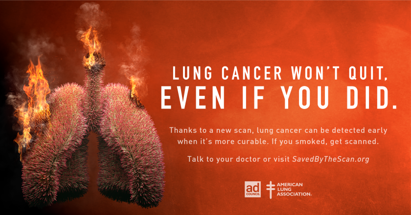 Lung Cancer PSA